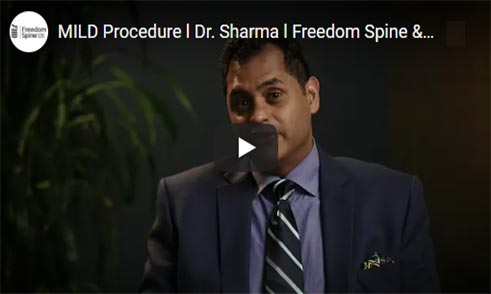 Dr. Sharma – MILD Procedure