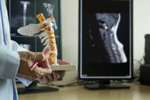 Doctor holding a replica of the human spine during a consultation with a patient about lumbar decompression
