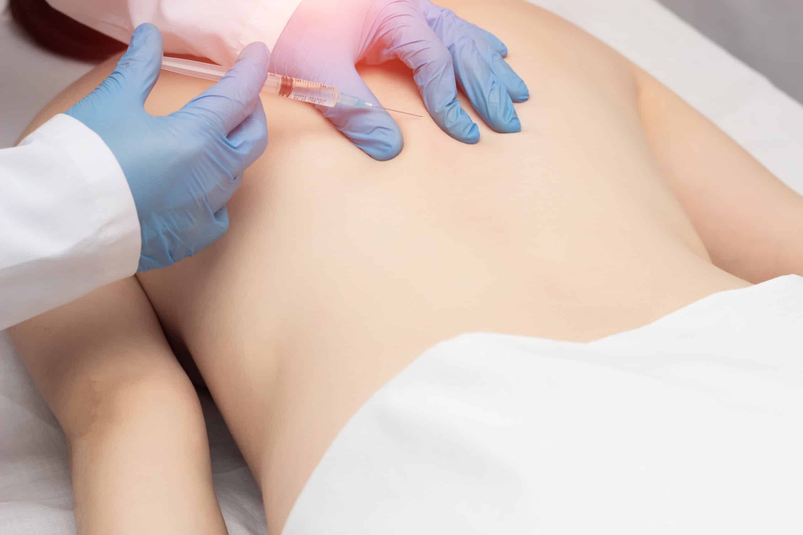 Doctor administering trigger paint injections into a patient's back to relieve chronic pain