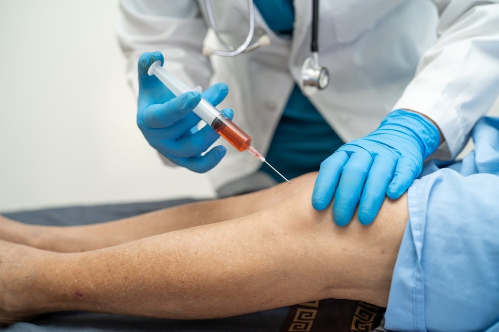 Close up of a patient about to receive a PRP injection to their knee to relieve their chronic pain.