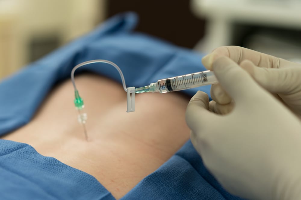Provider administering an epidural block into a patient's back with a medical gown draped over them.